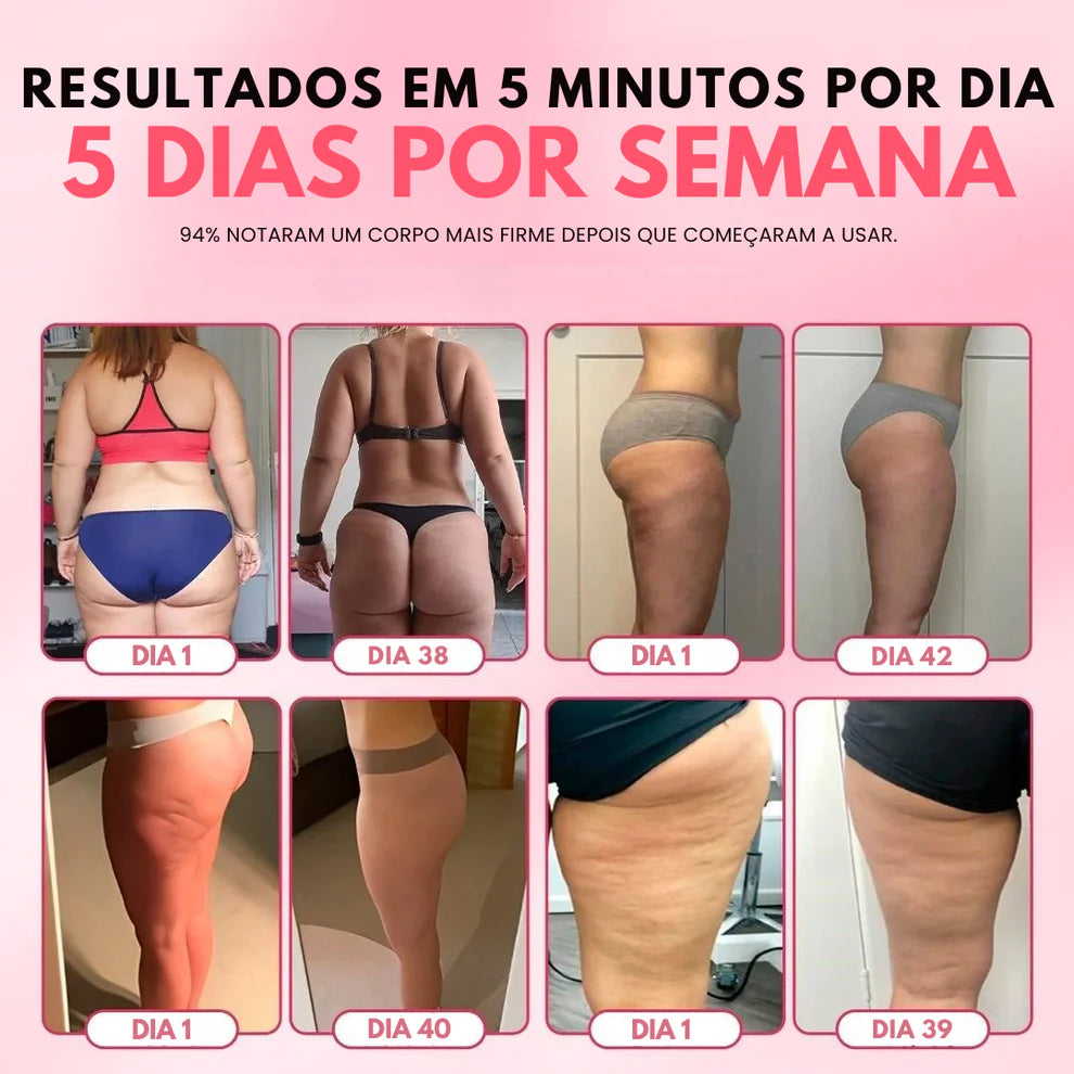 SmoothGlow™ - Massageador anticelulite