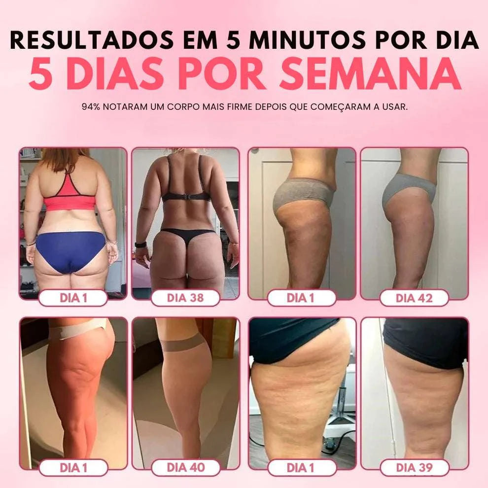 SmoothGlow™ - Massageador anticelulite Hycella | Confiança e Qualidade é a nossa marca