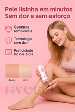Carregar imagem no visualizador da galeria, Depilador Elétrico 4 em 1 - DermaFlex® [Edição Limitada] Hycella | Confiança e Qualidade é a nossa marca
