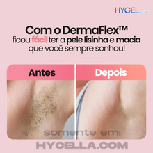 Carregar imagem no visualizador da galeria, Depilador Elétrico 4 em 1 - DermaFlex® [Edição Limitada] Hycella | Confiança e Qualidade é a nossa marca
