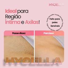 Carregar imagem no visualizador da galeria, Depilador Elétrico 4 em 1 - DermaFlex® [Edição Limitada] Hycella | Confiança e Qualidade é a nossa marca
