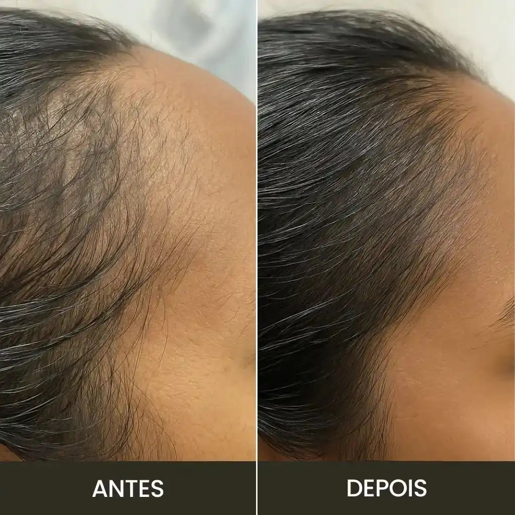 Escova de Terapia Capilar | TheraBrush Smarts 4 em 1 Hycella | Confiança e Qualidade é a nossa marca