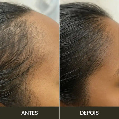 Escova de Terapia Capilar | TheraBrush Smarts 4 em 1 Hycella | Confiança e Qualidade é a nossa marca