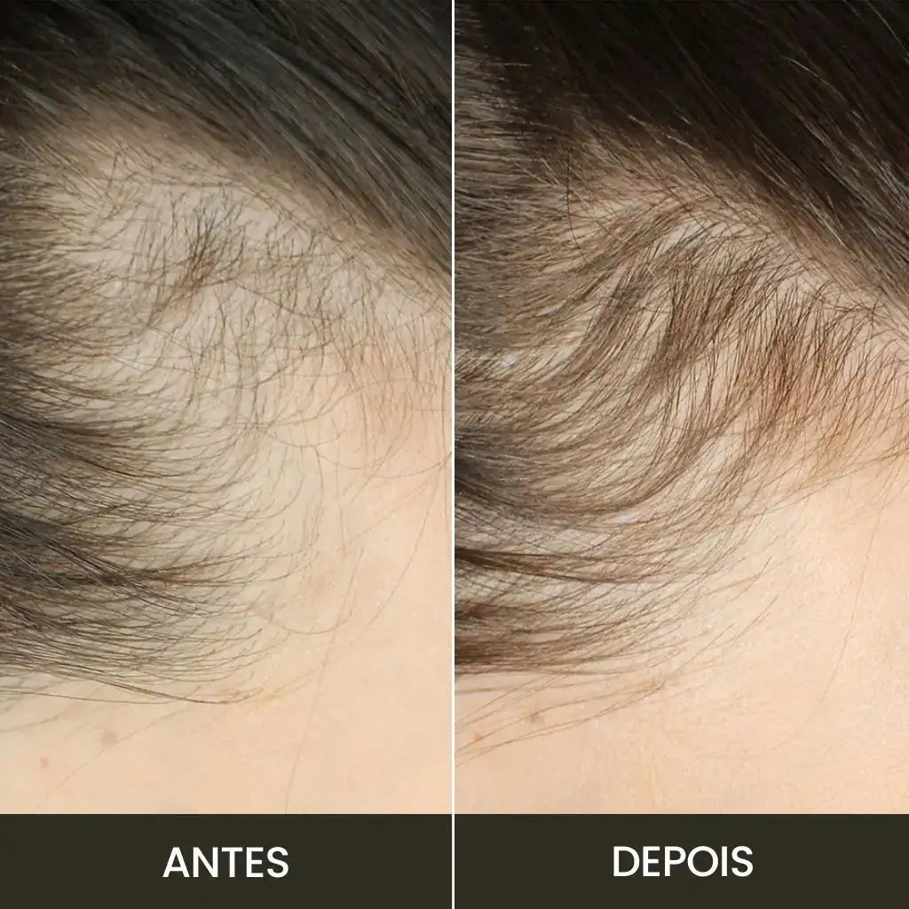 Escova de Terapia Capilar | TheraBrush Smarts 4 em 1 Hycella | Confiança e Qualidade é a nossa marca